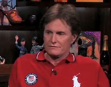 Bruce jenner facelift surgery : Photo