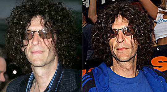 Howard Stern admits to plastic surgery