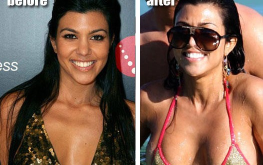 Kourtney Kardashian breast augmentation : Star Regret Plastic Surgery?