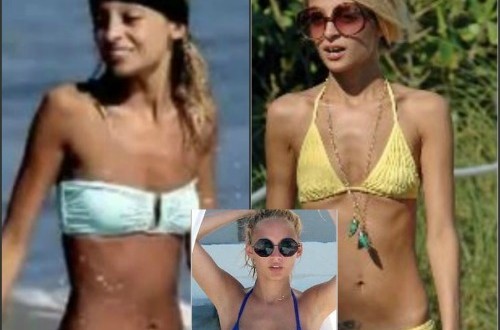 Nicole Richie breast augmentation