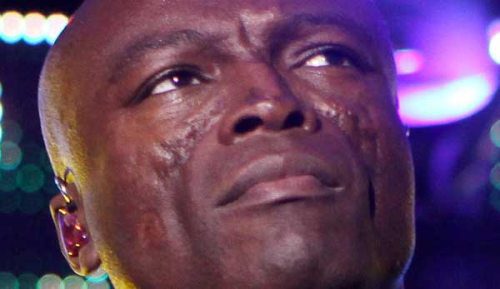 Seal scar : Singer suffers from Discoid Lupus