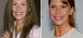 nikki cox cheek enhancement