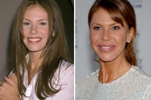 Plastic surgery gone bad : nikki cox cheek enhancement