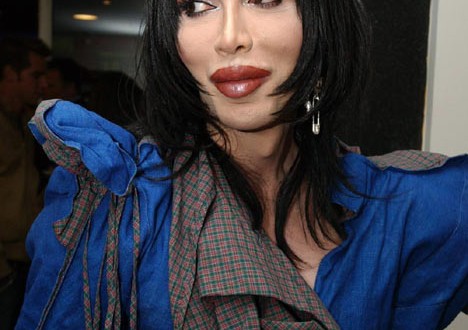 pete burns sues lip surgery