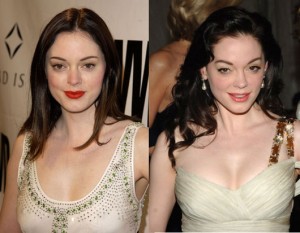 Rose mcgowan facelift, eyelids, fillers in lips and cheeks