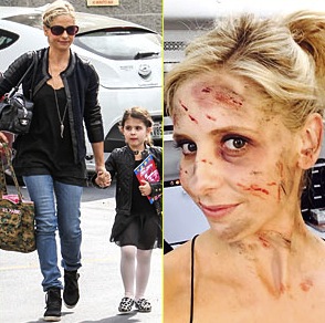 Sarah michelle gellar the crazy ones : Actress Is All Bloody and Banged Up