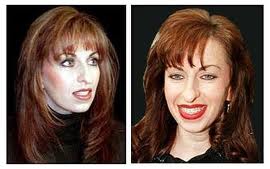 Paula Jones Undergoes Plastic Surgery