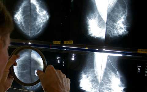 Cancer death rates decline in US : Study