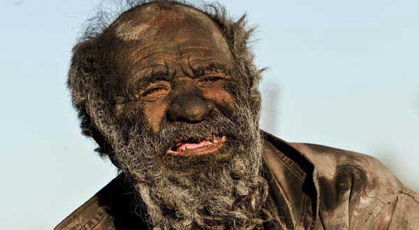 Iranian Man has gone 60 years without bathing
