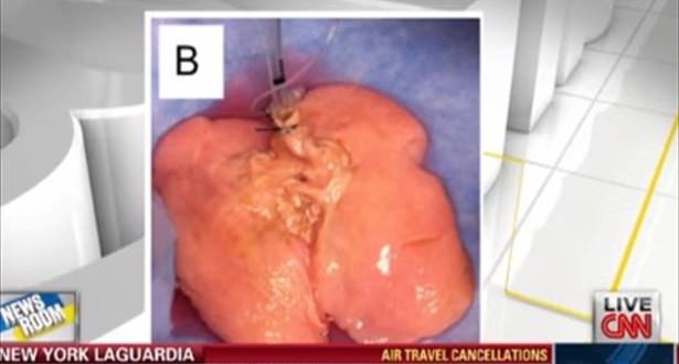 Researchers Grow Human Lung (Video)