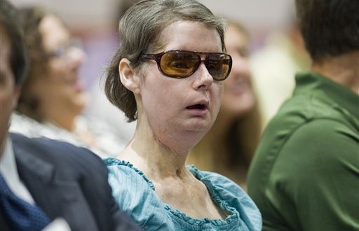 Chimp attack victim again tries to sue state