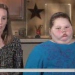 12-year-old gets gastric bypass surgery