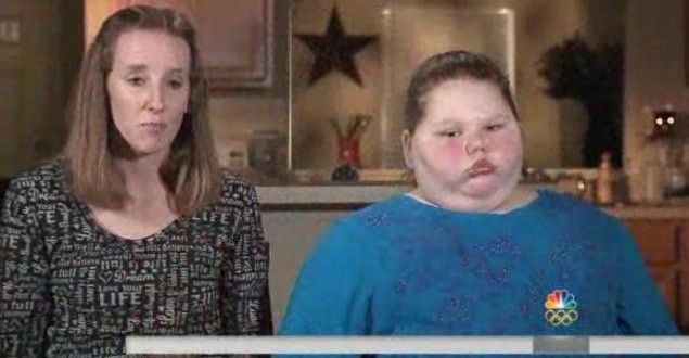 Girl, 12 year old, gets obesity surgery