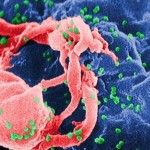 HIV cure? Second child born with virus now in remission