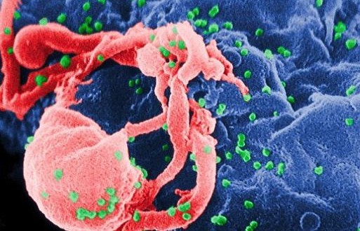 HIV cure? Second child born with virus now in remission