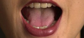 HPV linked to throat & mouth cancer?