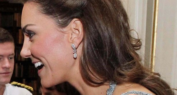 kate Middleton has scar on head, serious operation