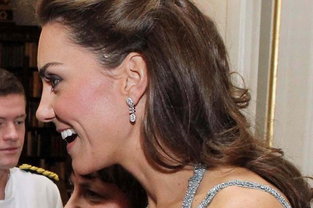 kate Middleton has scar on head, serious operation - Canada Journal