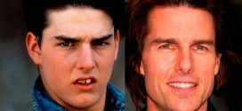 10 celebs who used to have horrible smiles
