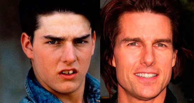 10 celebs who used to have horrible smiles