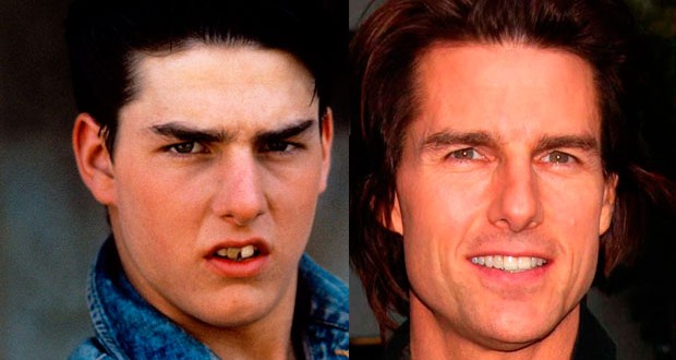 10 celebs who used to have horrible smiles (Photo)