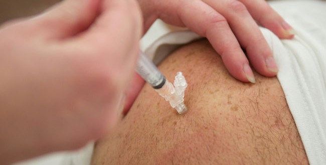 Health officials : Possible measles exposure at Sudbury locales
