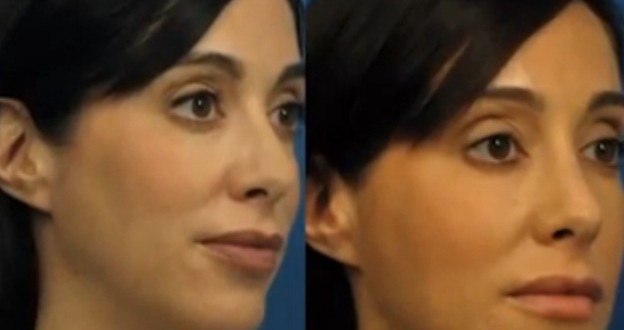 Woman Gets 15k-Plastic Surgery For Better Selfies