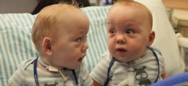 Conjoined Twins Leave Dallas Hospital after separation