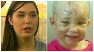 Mom bites off pitbull's ear to save daughter