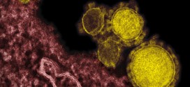 3rd MERS case confirmed in US