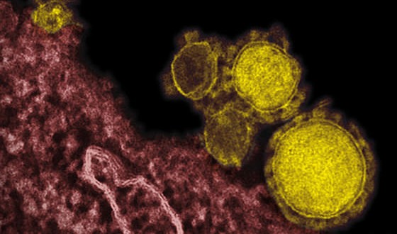 3rd MERS case confirmed in US