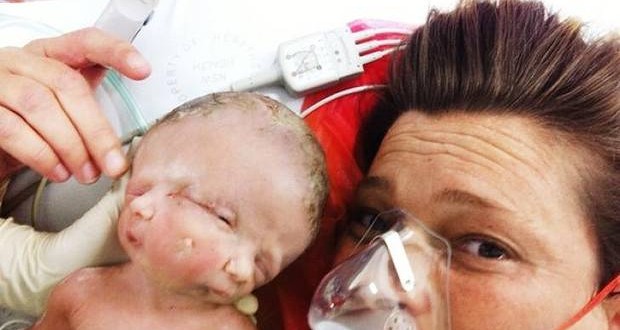 Australian Conjoined twins Faith and Hope have died after 19 days