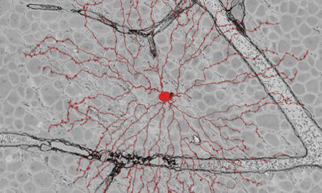 Computer Game Aides Scientist Mapping Eye Nerve Cells (Video)