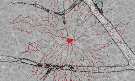 Computer Game Aides Scientist Mapping Eye Nerve Cells