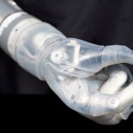 FDA : Advanced prosthetic arm is approved for US market