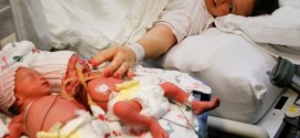 Monoamniotic twins arrive as early Mother's Day gift