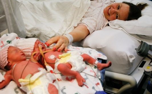 Monoamniotic twins arrive as early Mother's Day gift