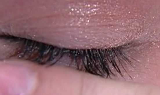 Florida women claim COVERGIRL mascara made eyelashes fall out
