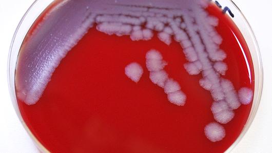 Scientists possibly exposed to anthrax : CDC
