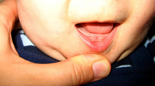 US : FDA gives advice on teething children