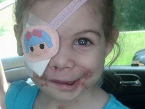 Victoria Wilcher : Girl scarred by pit bull attack asked to leave KFC