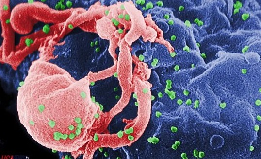 Celgene Drug has Great Potential for HIV Therapy, study claims