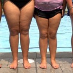 Most Overweight Kids Believe They Are Right Weight, Study