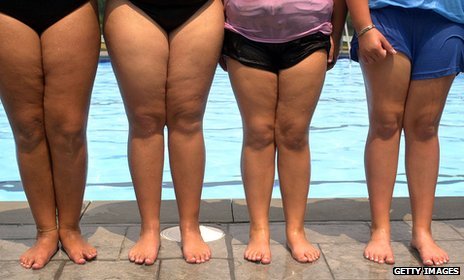 Most Overweight Kids Believe They Are Right Weight, Study