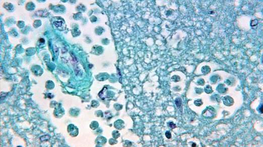 Brain-eating bugs found in towns' water system