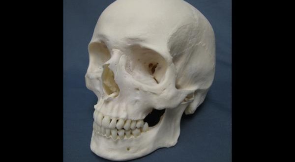 RCMP : Skull mystery emerges from garage in Hinton