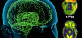 Schizophrenia is eight different diseases, not one : New Study