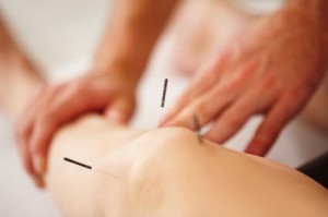 Acupuncture is 'not beneficial for knee pain', Study Reports