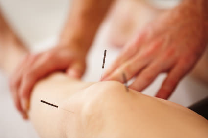 Acupuncture is ‘not beneficial for knee pain’, Study Reports