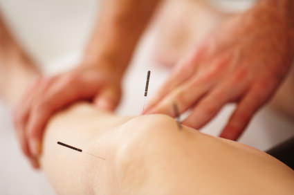 Acupuncture is 'not beneficial for knee pain', Study Reports